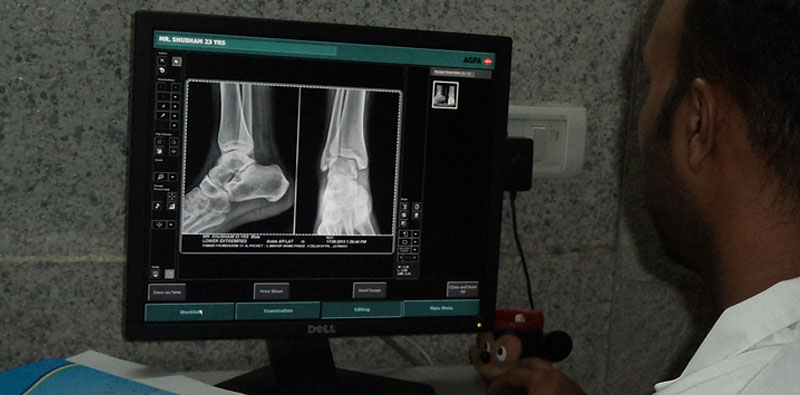 Digital X-Rays